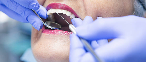 Best Emergency Dentist for Lost Fillings or Crowns in Bay Hill, FL
